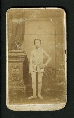 Photograph: Portrait of Fritz Smith in his acrobat costume with silver belt, 1862